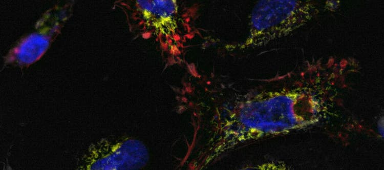 Cells Apoptosis Inducer