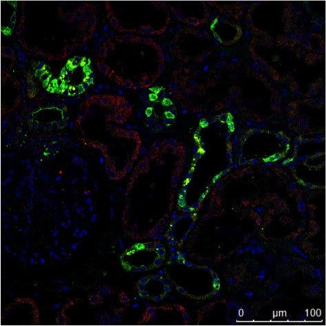 Prepare Your Specimen for Immunofluorescence Microscopy