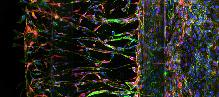 3D High-Content Imaging