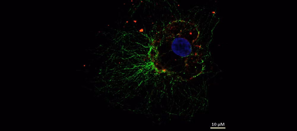 Prepare Your Specimen for Immunofluorescence Microscopy