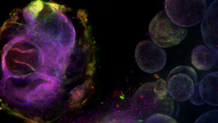 3d Organoid Screening