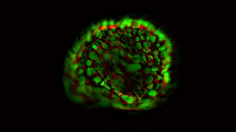 Organoid