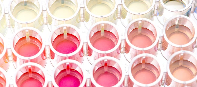 Selecting the Right Cell-Based Assay