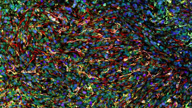 spatial proteomics