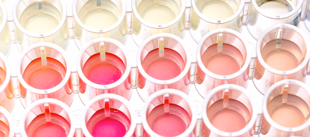Selecting the Right Cell-Based Assay
