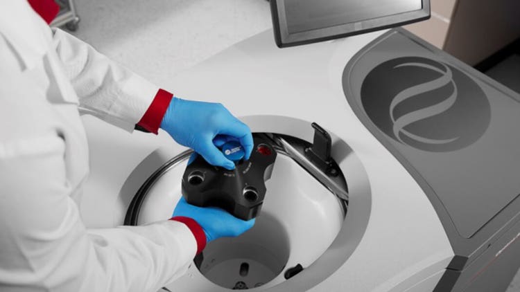 Viral Vector Separation