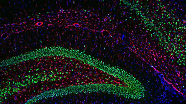 Multicolor Microscopy
