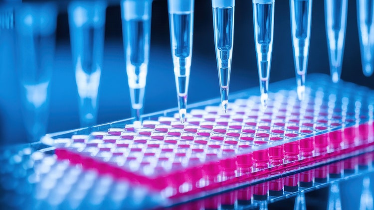 Automated Mass Characterization