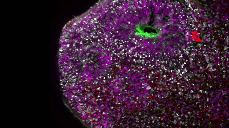 3d Organoid Analysis