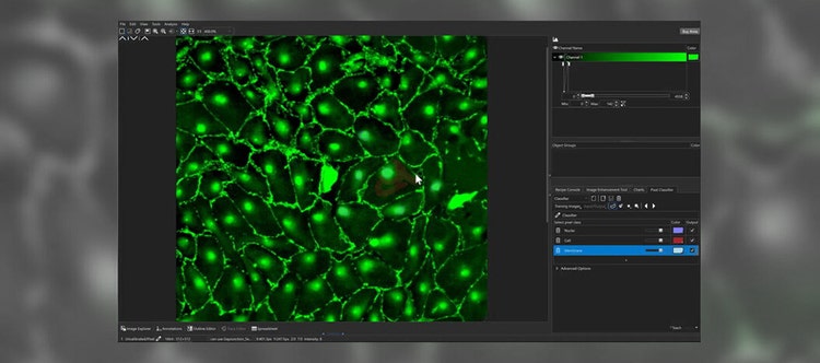 Machine Learning in Microscopy Image Analysis