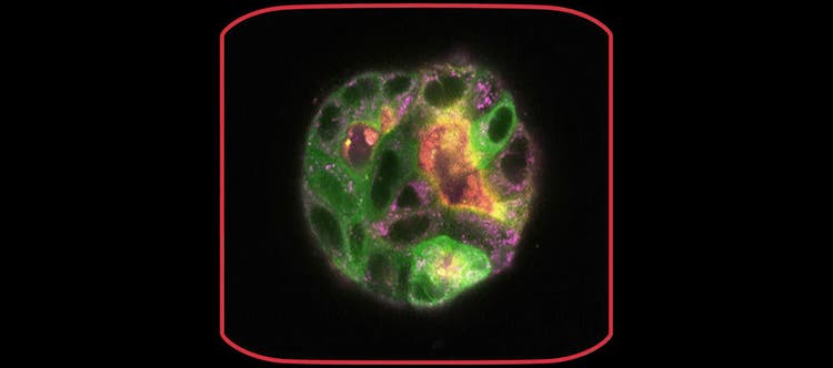 Perform Fast & Stable Multicolor Live-Cell Imaging