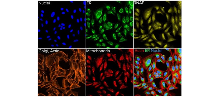 Cell Painting is Making its Mark on Drug Discovery