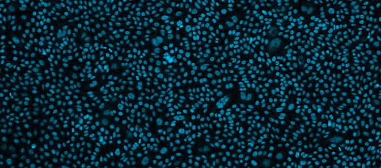 CHO Cells’ Role in Cell Line Development