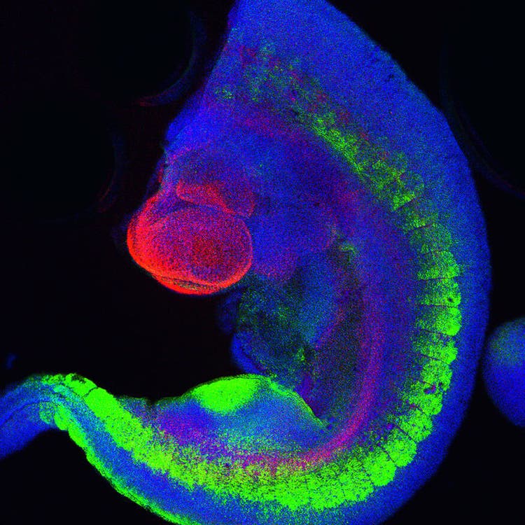 CSM Mouse Transgenic Embryo