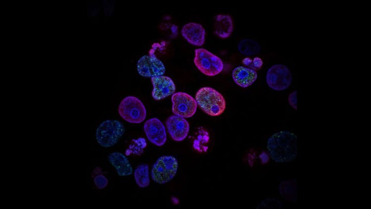 Revolutionizing drug screening