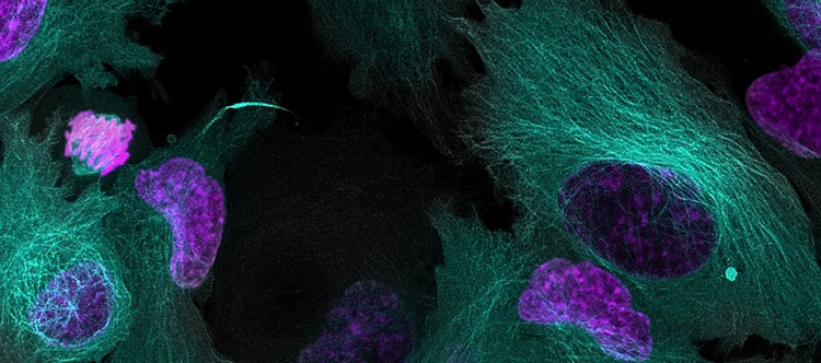 Considerations for Multiplex Live Cell Imaging