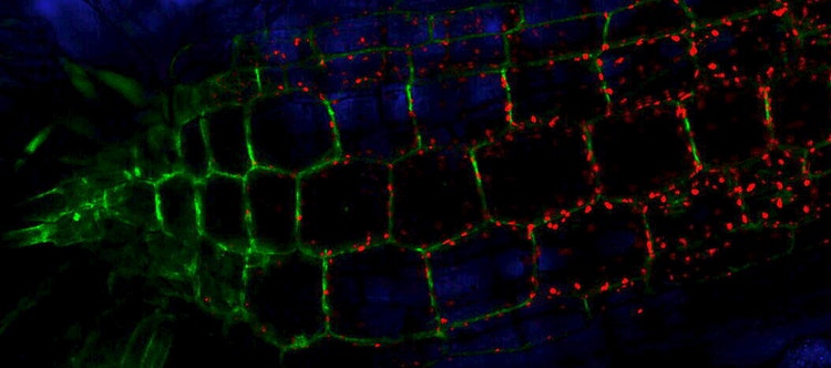 Live-Cell Imaging Techniques