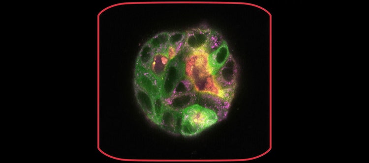 Perform Fast & Stable Multicolor Live-Cell Imaging