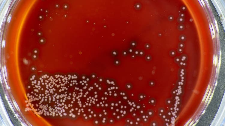 Optimizing Plasmid