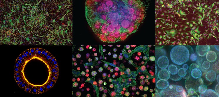 Engineering Next-gen Organoids