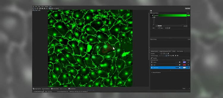 Machine Learning in Microscopy Image Analysis