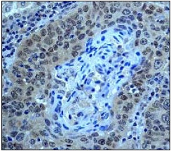 Anti-Smad4 antibody