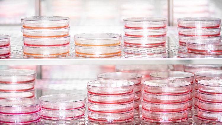 Suspension Cell Culture
