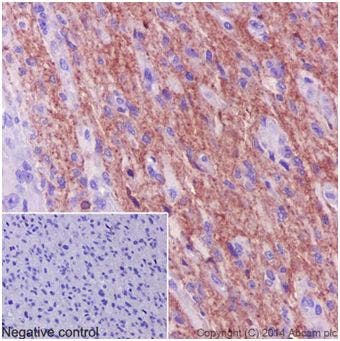Anti Pan Trk antibody