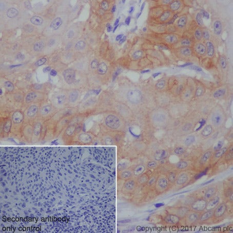 Egfr antibody ep38y