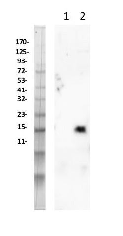 Cleaved caspase-3 antibody