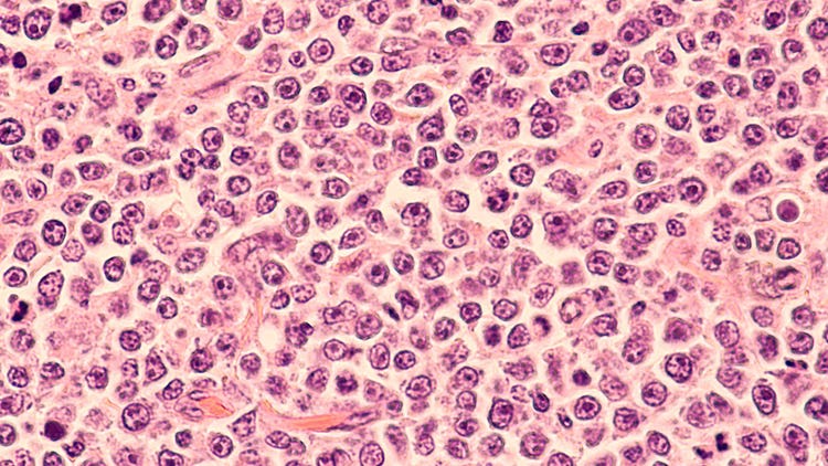 B Cell Antibody Production