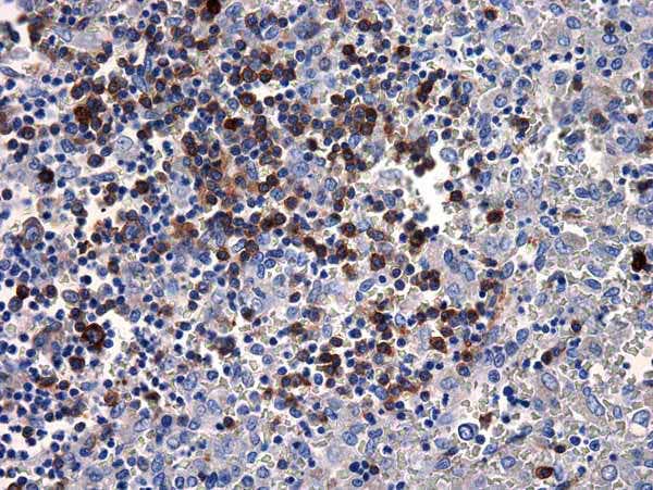 Human igm antibody