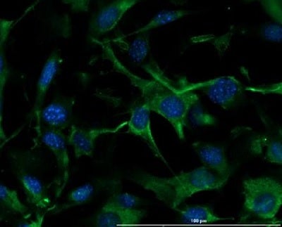 Collagen iv antibody