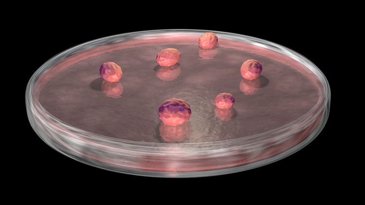 organoid