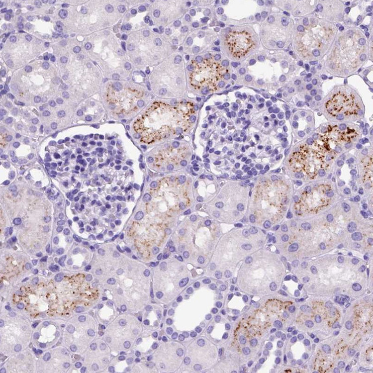 IGF2 antibody