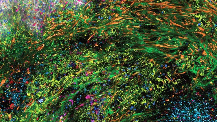 3D high-plex imaging in Cancer Immunology