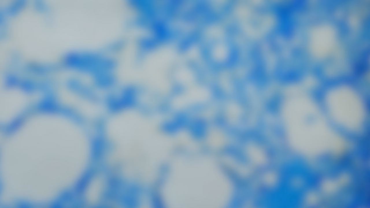 Flexacam I5 DM500 Monitor Sample Blur Kid21764405