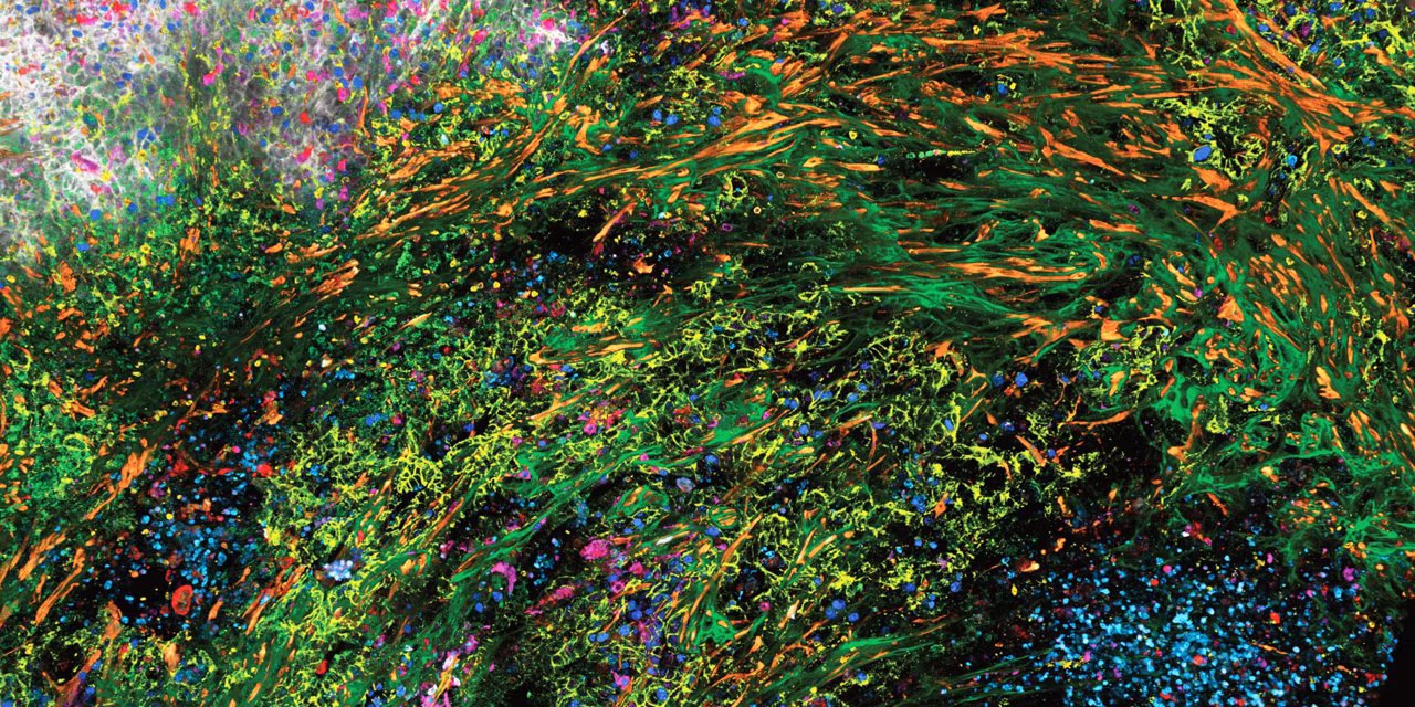 Leica Microsystems Spectraplex For Spatial Biology Hero