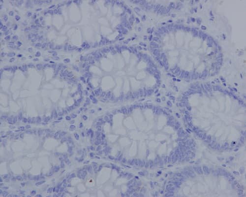 Anti-Aggrecan antibody [EPR14664] - BSA and Azide free(AB232628)