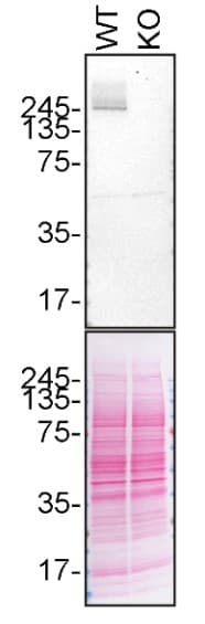 Anti-LRRK2 antibody [MJFF2 (c41-2)](AB133474)
