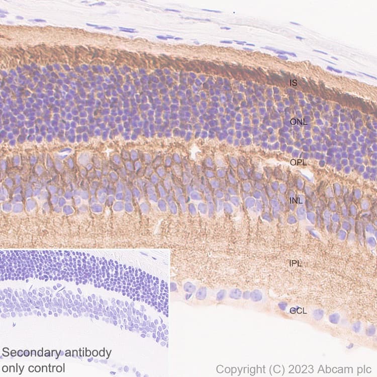 Anti-RS1 antibody [EPR28513-78](AB314231)