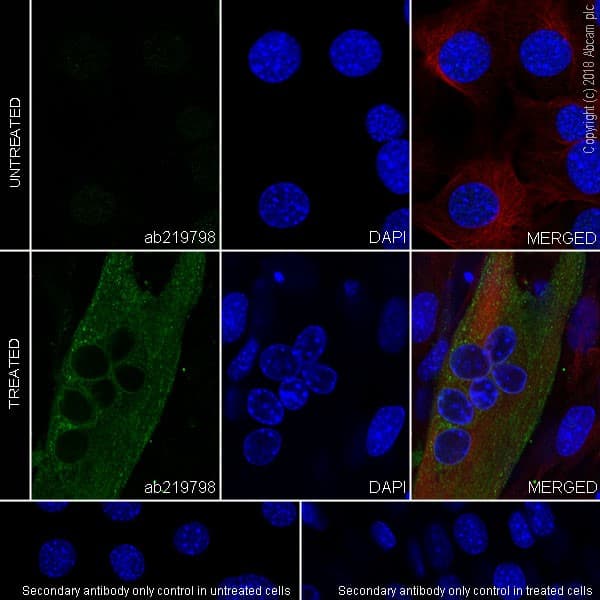 Anti-Ryanodine Receptor antibody [EPR21796](AB219798)