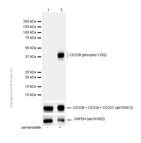 Anti-CD32B (phospho Y292) antibody [EP926Y](AB68423)