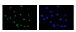 Rbm6 Antibody Epr15842 C Terminal Ab188318  Immunocytochemistry Immunofluorescence Img1558
