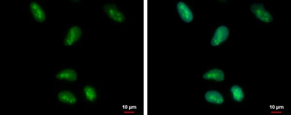 Hmgb1 Antibody N Terminal Ab228624  Immunocytochemistry Immunofluorescence Img119125