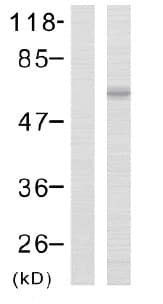 Limk2 Phospho T505 Antibody Ab38499  Western Blot Img36251