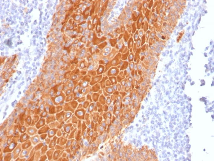 Anti-pan Cytokeratin antibody [PAN-CK (Cocktail)](AB215838)