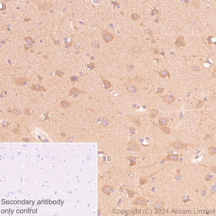 Mtor Antibody Rm1258 Ab322444  Immunohistochemistry Formalin Pfa Fixed Paraffin Embedded Sections Img438197