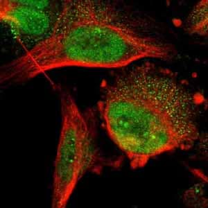 Dnajc14 Antibody Ab121535  Immunocytochemistry Immunofluorescence Img30652