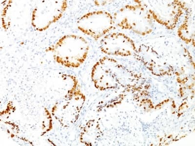 Anti-TTF1/Nkx2-1 antibody [8G7G3/1](AB233977)